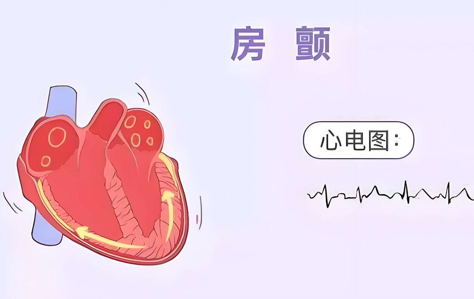 11e945541d10c6ee1f76206e48e624a4.png